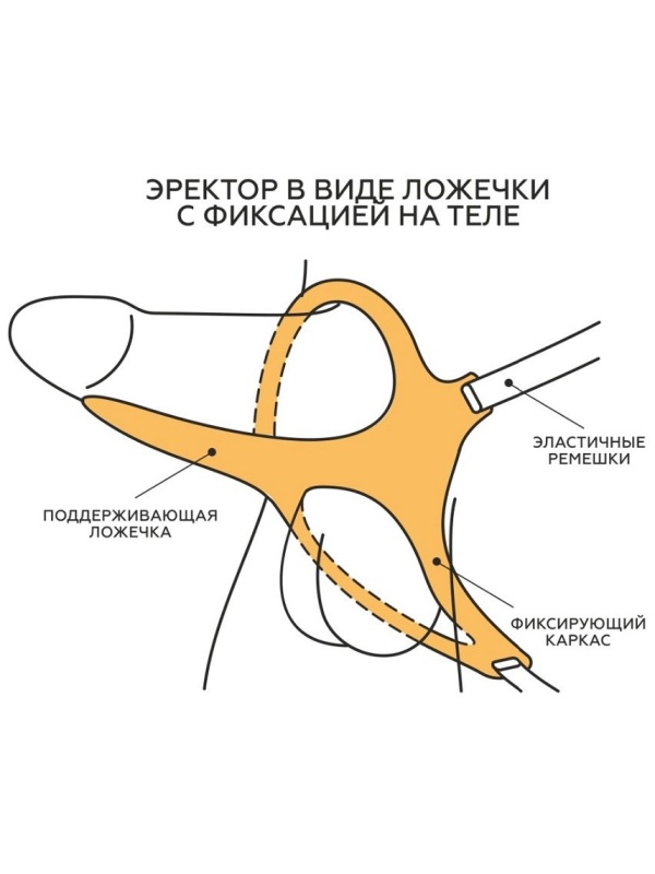 Эректор с фиксацией