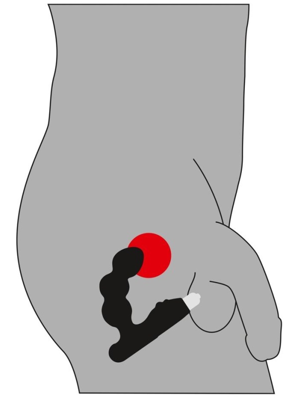 Стимулятор простаты с вибрацией Rebel Bead-shaped Prostate Stimulator