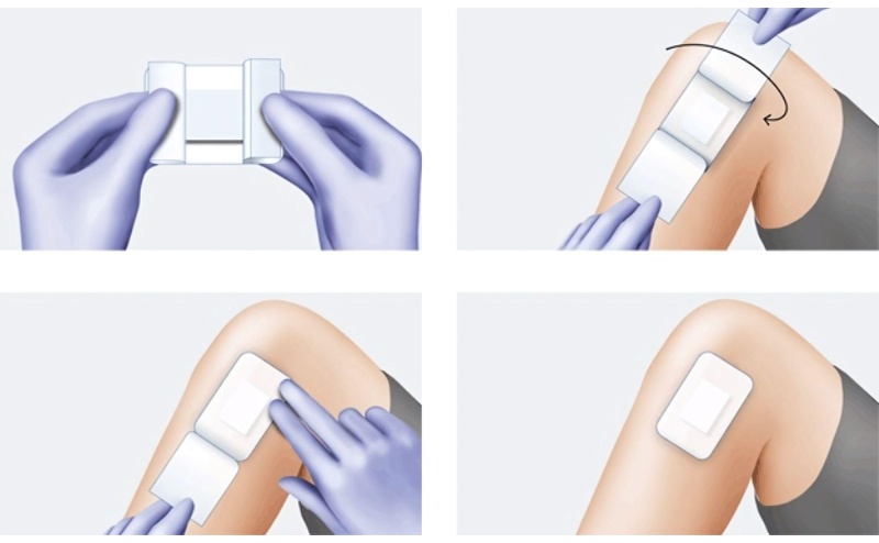 Повязка самоклеящ. стер п/операц. 20см х 10см,COSMOPOR, 25 шт/уп